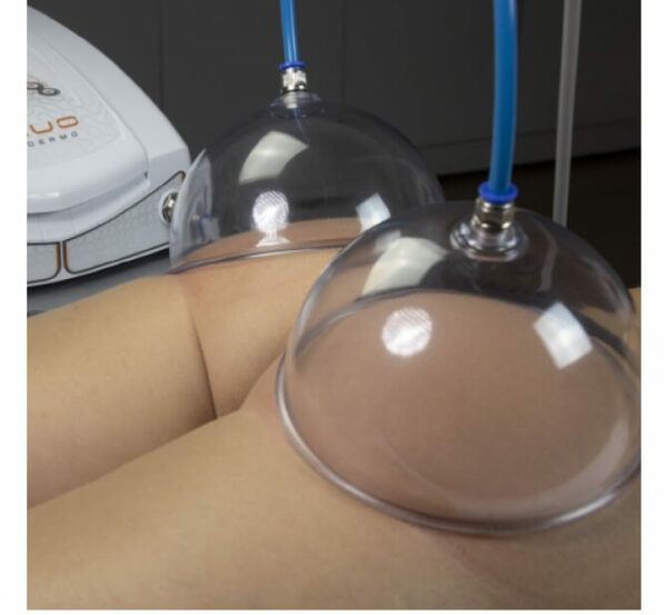 b_hygiadermo-vacuo-aparelho-de-vacuoterapia-kld-1 b_hygiadermo-vacuo-aparelho-de-vacuoterapia-kld-1