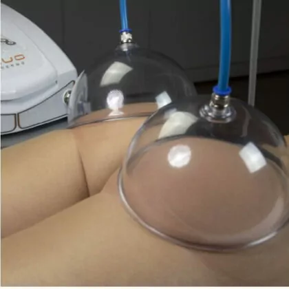 b_hygiadermo-vacuo-aparelho-de-vacuoterapia-kld-1